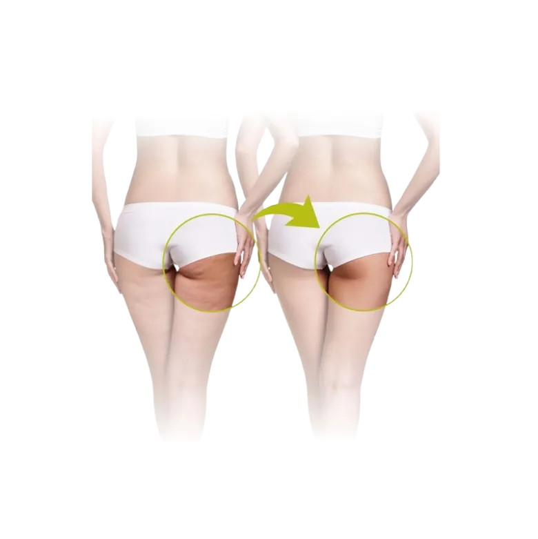 Appareil de massage anti-cellulite Lanaform Call Roller