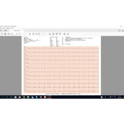Application logicielle ECG EasyApp pour ECG 100L Cardioline