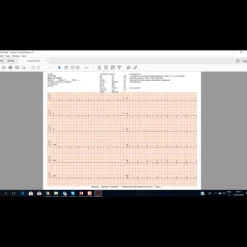 Application logicielle ECG EasyApp pour ECG 100L Cardioline