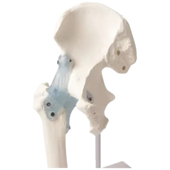 Articulation de la hanche avec des ligaments Erler Zimmer