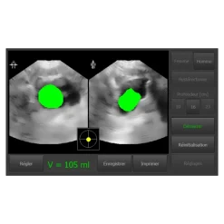 Bladder scanner / Scanner vésical USB Vitascan LT