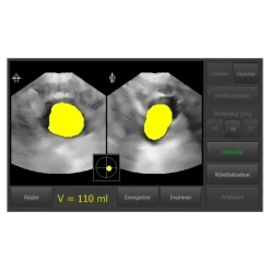 Bladder scanner / Scanner vésical USB Vitascan LT