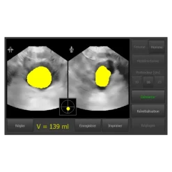 Bladder scanner / Scanner vésical USB Vitascan LT