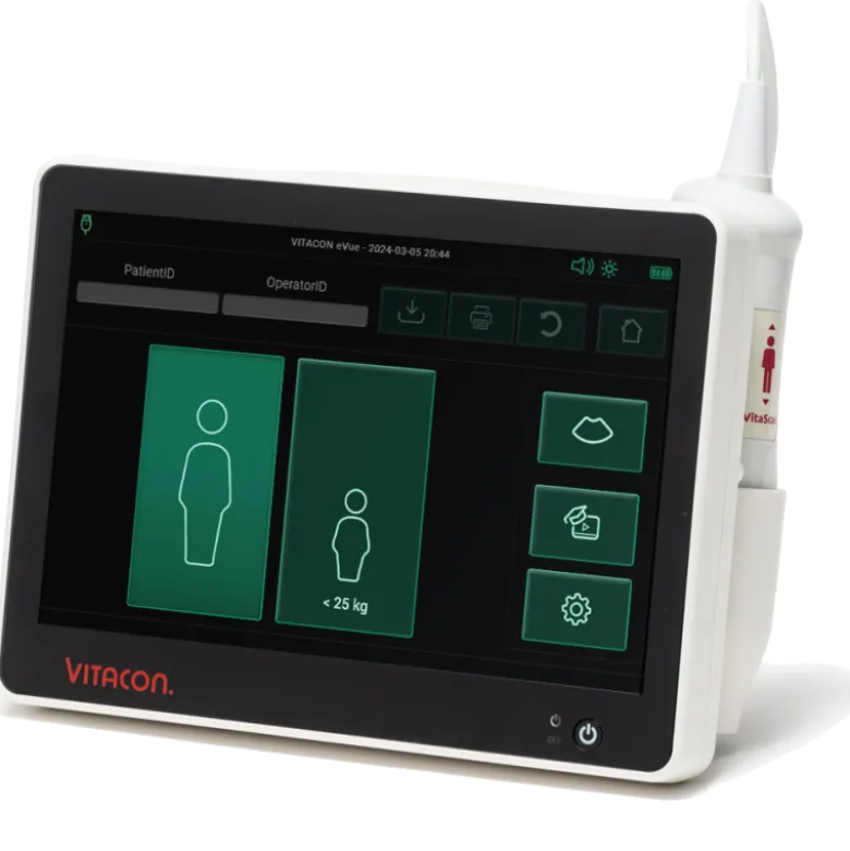 Bladder scanner / Scanner vésical portable VitaScan eVue