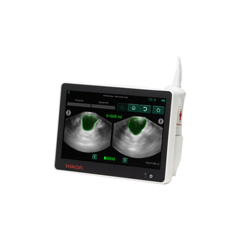 Bladder scanner / Scanner vésical portable VitaScan eVue