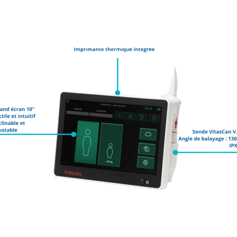 Bladder scanner / Scanner vésical portable VitaScan eVue