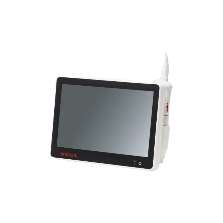 Bladder scanner / Scanner vésical portable VitaScan eVue