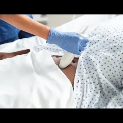 Bladder scanner / Scanner vésical avec pied à roulettes VitaScan cVue