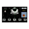 Bladder scanner / Scanner vésical portable Peaksonic BladderView M4