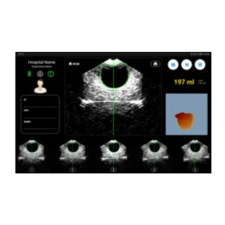 Bladder scanner / Scanner vésical portable Peaksonic BladderView M4