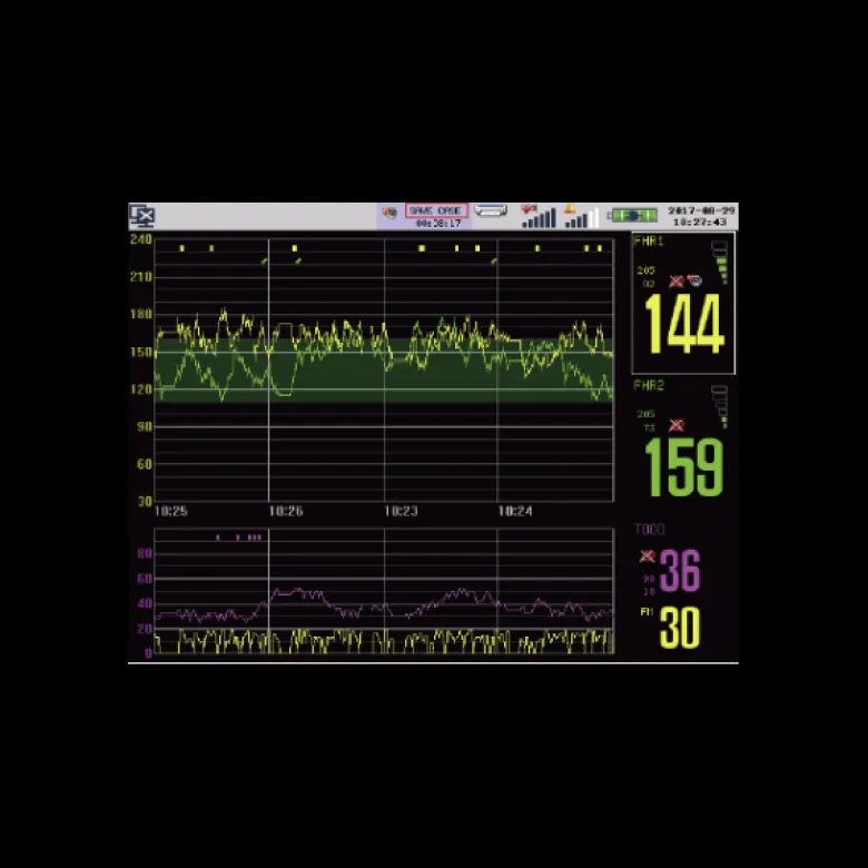 Cardiotocographe / Moniteur foetal gémellaire Comen C11 avec fonction VCT