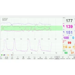 Cardiotocographe / Moniteur foetal pour grossesse multiples EDAN F15 avec VCT