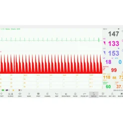 Cardiotocographe / Moniteur foetal pour grossesse multiples EDAN F15 AIR avec VCT