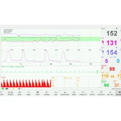 Cardiotocographe / Moniteur foetal pour grossesse multiples EDAN F15 AIR avec VCT
