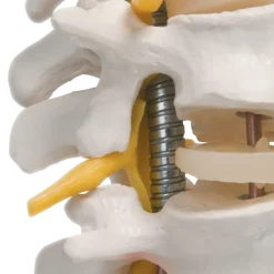 Colonne vertébrale flexible avec support