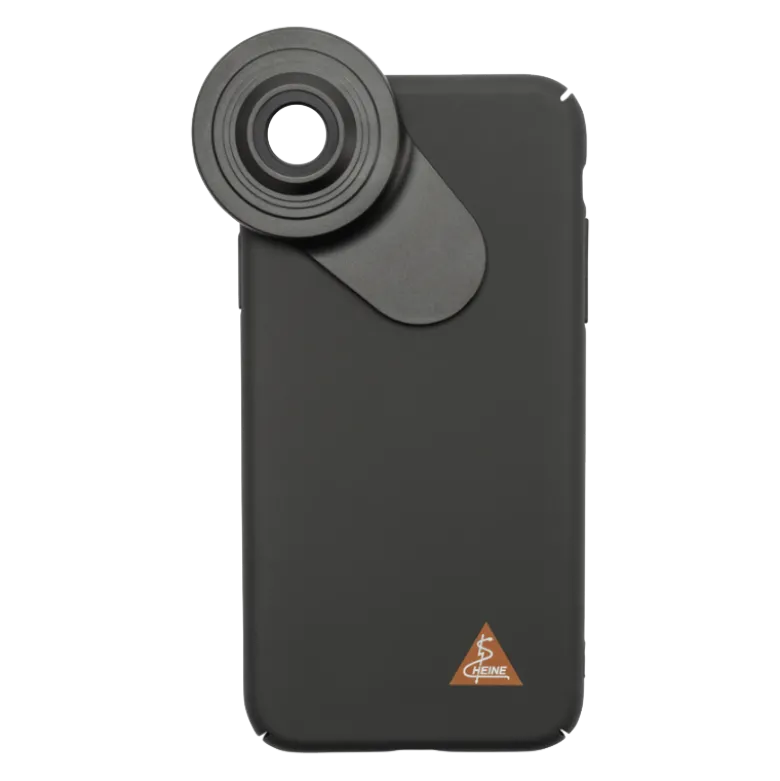 Coque d'adaptation pour smartphone Apple pour dermatoscope Heine Delta 30 et DeltaOne