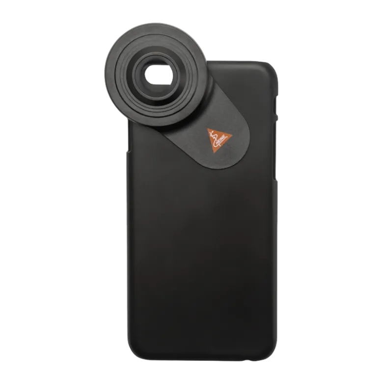 Coque d'adaptation pour smartphone Apple pour dermatoscope Heine Delta 30 et DeltaOne