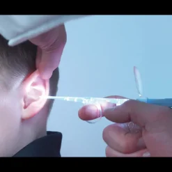 Curettes auriculaires articulées Bionix Lighted Ear (boite de 25)