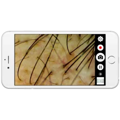 Dermatoscope digital Firefly sans fil