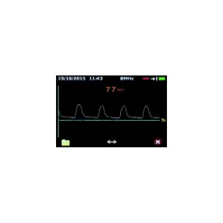 Doppler de poche bidirectionnel Dopplex DMX (avec sonde 4, 5, 8 ou 10 Mhz)