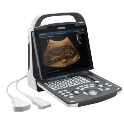Echographe portable à ultrasons Mindray DP-20 (niveaux de gris)