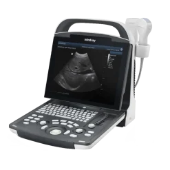 Echographe portable à ultrasons Mindray DP-20 (niveaux de gris)