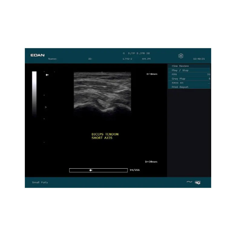 Echographe portable à ultrasons Edan DUS60 (niveaux de gris)