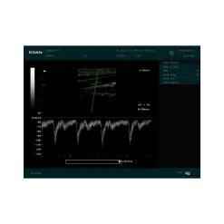 Echographe portable à ultrasons Edan DUS60 (niveaux de gris)