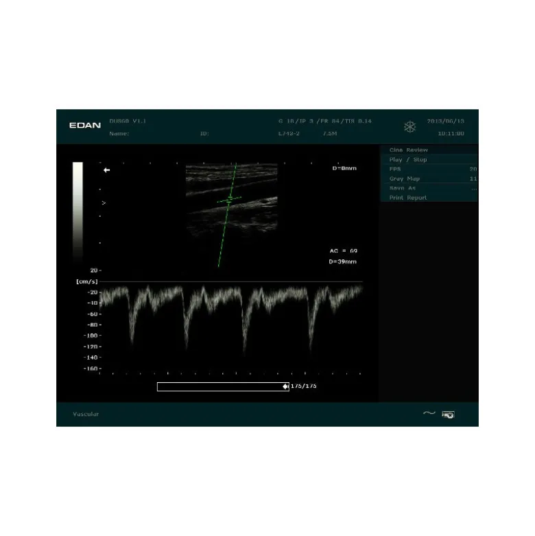 Echographe portable à ultrasons Edan DUS60 (niveaux de gris)