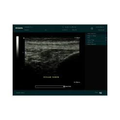 Echographe portable à ultrasons Edan DUS60 (niveaux de gris)