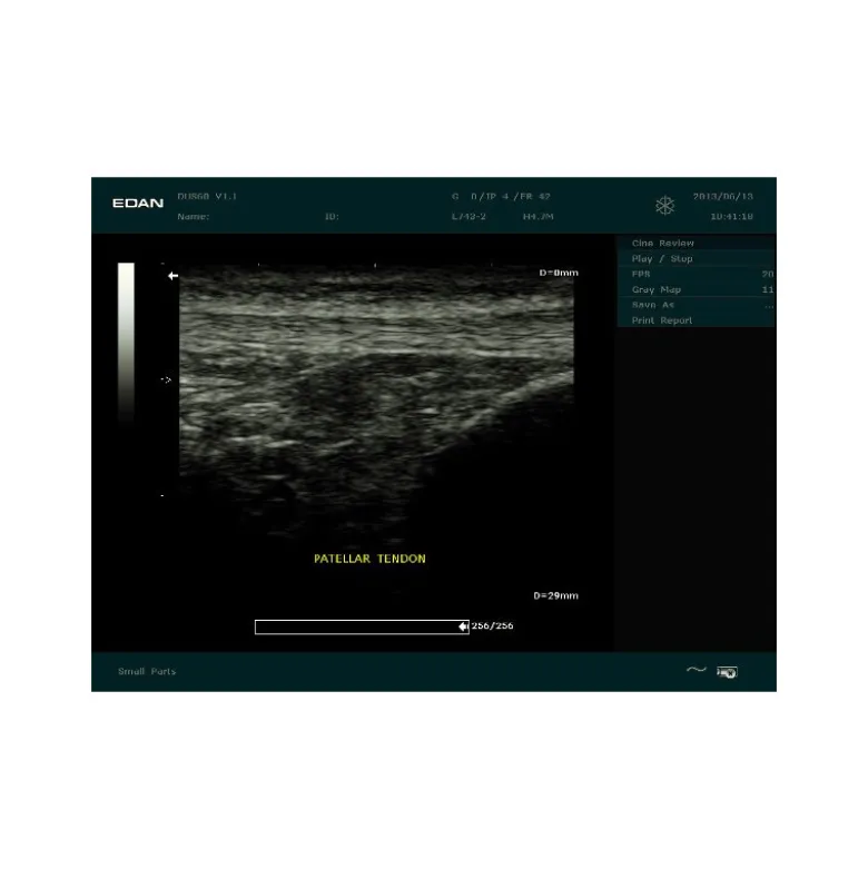 Echographe portable à ultrasons Edan DUS60 (niveaux de gris)