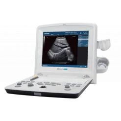 Echographe portable à ultrasons Edan DUS60 (niveaux de gris)
