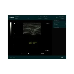 Echographe portable à ultrasons Edan DUS60 (niveaux de gris)
