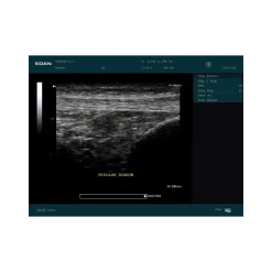 Echographe portable à ultrasons Edan DUS60 (niveaux de gris)