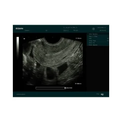 Echographe portable à ultrasons Edan DUS60 (niveaux de gris)