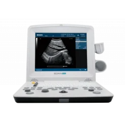 Echographe portable à ultrasons Edan DUS60 (niveaux de gris)