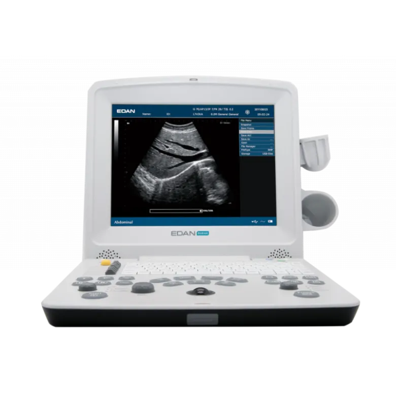Echographe portable à ultrasons Edan DUS60 (niveaux de gris)