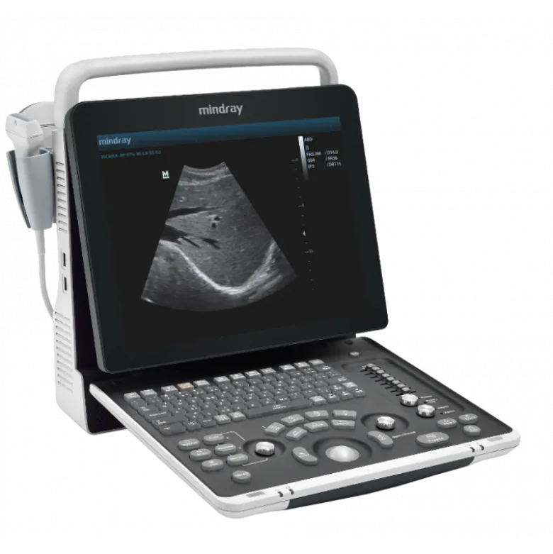Echographe portable à ultrasons MINDRAY DP-50 Expert (couleur)