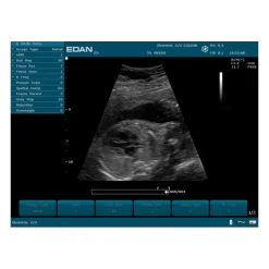 Echographe portable à ultrasons Edan U50 (couleur)
