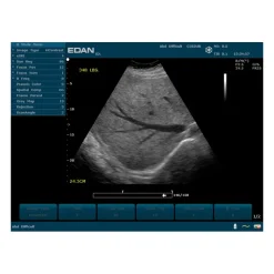 Echographe portable à ultrasons Edan U50 (couleur)