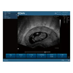 Echographe portable à ultrasons Edan U50 (couleur)