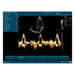 Echographe portable à ultrasons Edan U50 (couleur)