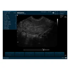 Echographe portable à ultrasons Edan U50 (couleur)