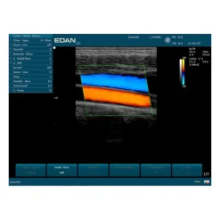 Echographe portable à ultrasons Edan U50 (couleur)