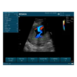 Echographe portable à ultrasons Edan U50 (couleur)