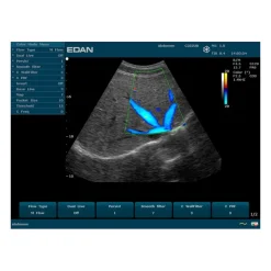 Echographe portable à ultrasons Edan U50 (couleur)