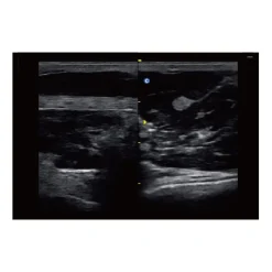 Echographe portable à ultrasons Chison ECO3 EXPERT (niveaux de gris)