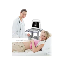 Echographe portable à ultrasons Chison ECO3 EXPERT (niveaux de gris)