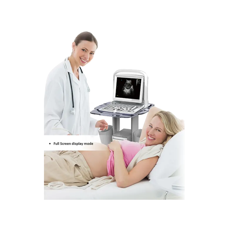 Echographe portable à ultrasons Chison ECO3 EXPERT (niveaux de gris)