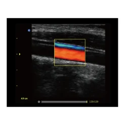 Echographe portable à ultrasons Chison ECO5 (couleur)